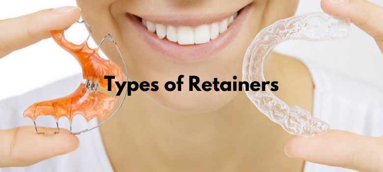 Read more about the article Types of Retainers: Hawley vs Essix vs Vivera