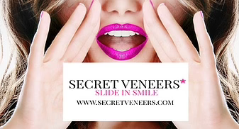 #4: Secret Veneers™