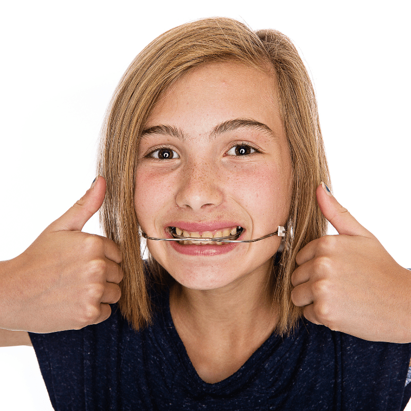 White background. A kid with their thumbs up, smiling. They are wearing an orthodontic headgear